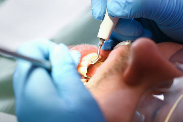 Best Emergency Denture Repair in Whitehall, MI