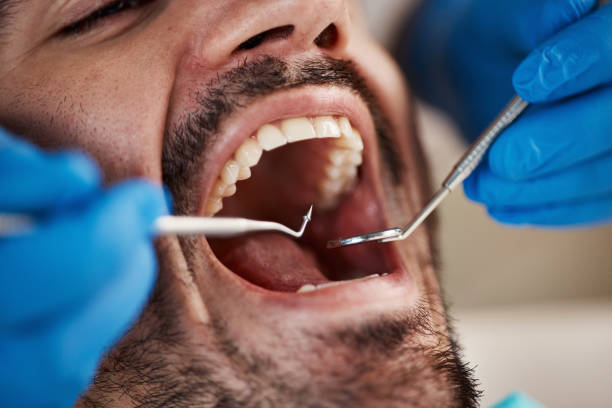 Best Emergency Dental Care for Sports Injuries in Whitehall, MI