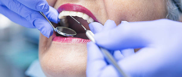 Best Broken or Chipped Tooth Repair in Whitehall, MI